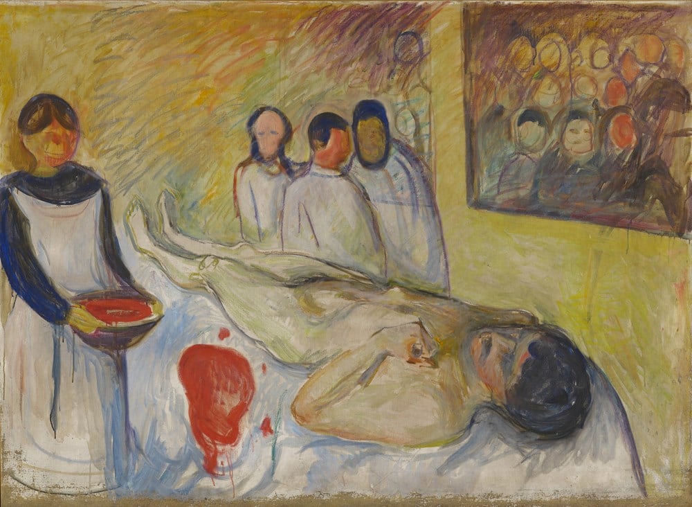 A man on the operation table, on his back, with the head towards the lower right corner. On the left hand side you see a nurse and in the back of the painting you see a group of three doctors.